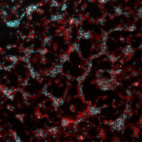 HUVEC cells stimulated with VEGF on a polymer surface. Image credit: Vladimira Moulisova.