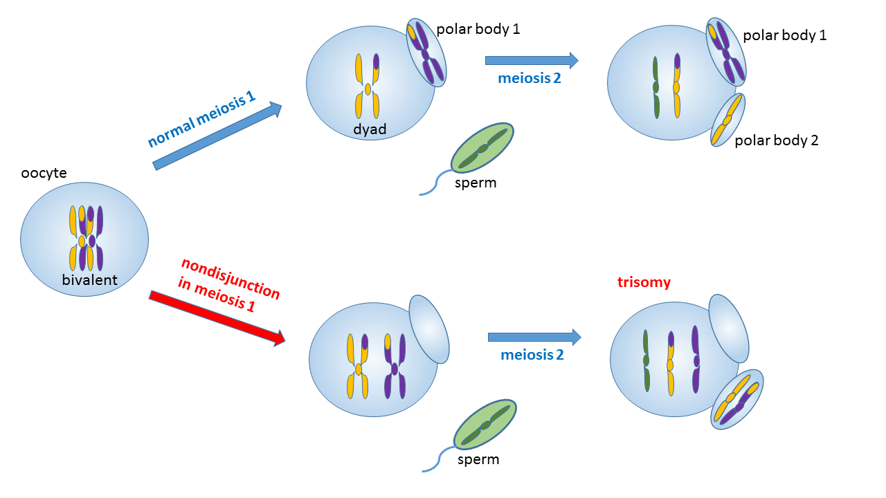 Trisomy_due_to_nondisjunction_in_maternal_meiosis_1