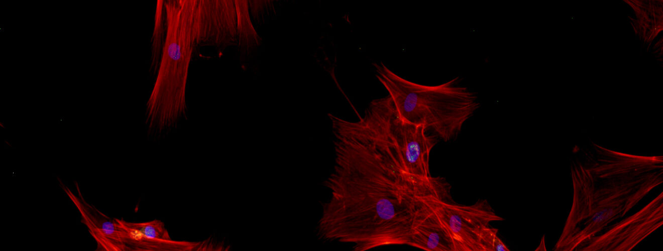 Image: mesenchymal stem cells photographed by Teodora Aldea