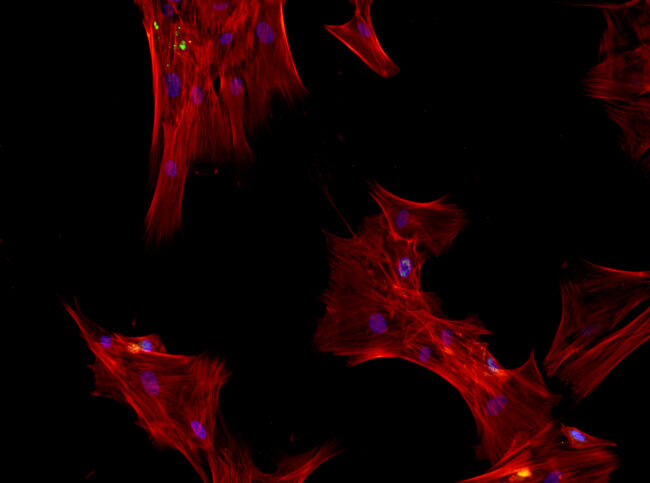 Image: mesenchymal stem cells photographed by Teodora Aldea