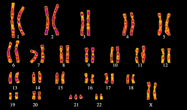 Spectral Karyotype of a female with trisomy 21. Image credits: http://scienceblogs.com/pharyngula/2014/03/01/marthe-gautier-another-woman-scientist-trivialized/
