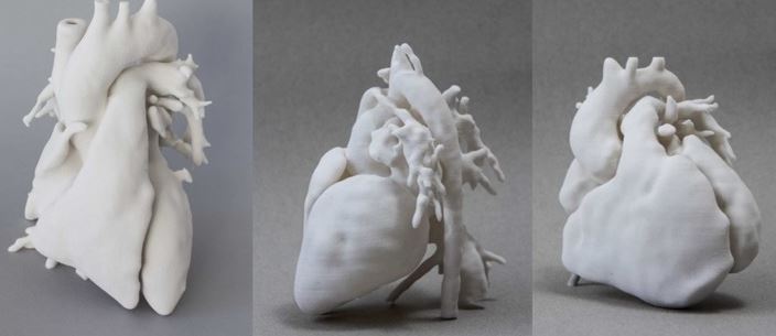 Stepping the printing game: the first 3D heart from – theGIST