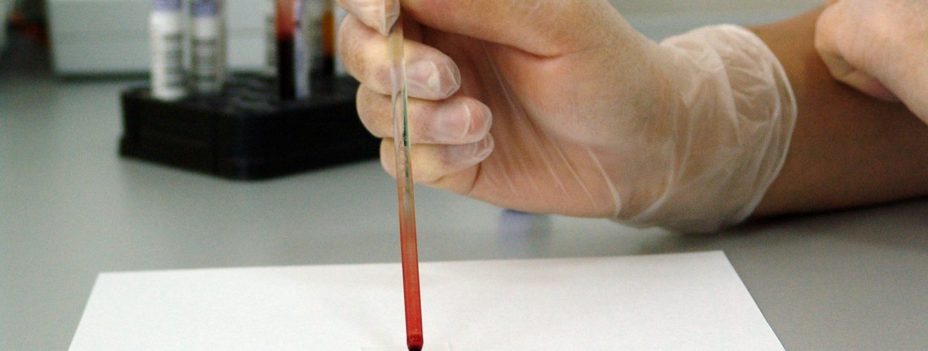 Photo of a lab technician's gloved hand holding a pipette