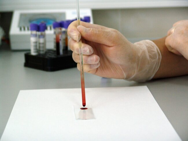 Photo of a lab technician's gloved hand holding a pipette