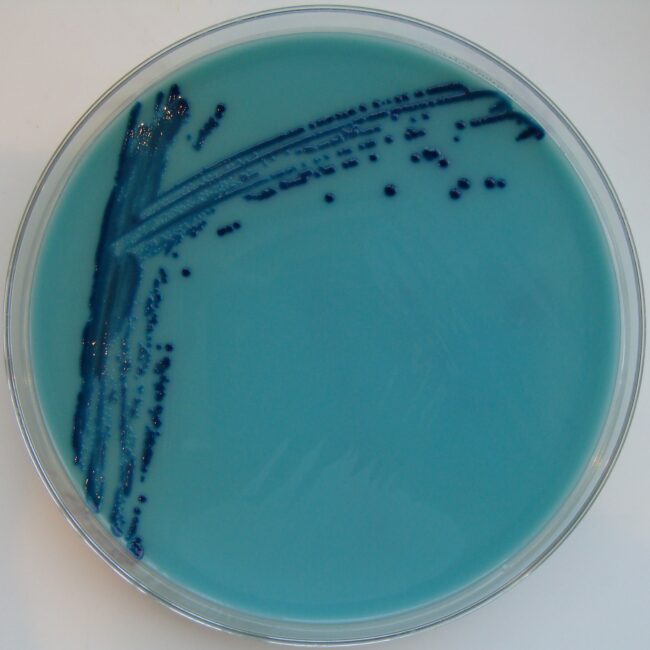 Photo of Klebsiella pneumoniae KPC-2 growing on Oxoid Brilliance CRE agar