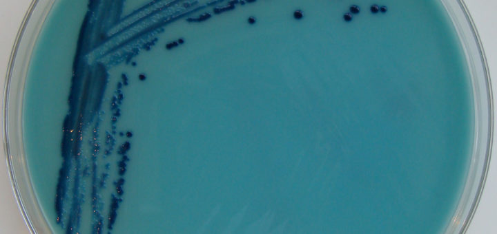 Photo of Klebsiella pneumoniae KPC-2 growing on Oxoid Brilliance CRE agar