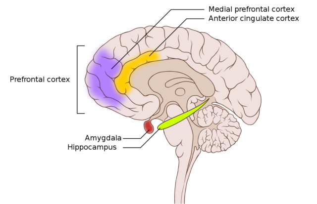 anxiety disorder brain