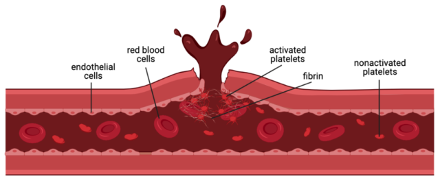 Villainous blood clots: Is the fear justified? – theGIST